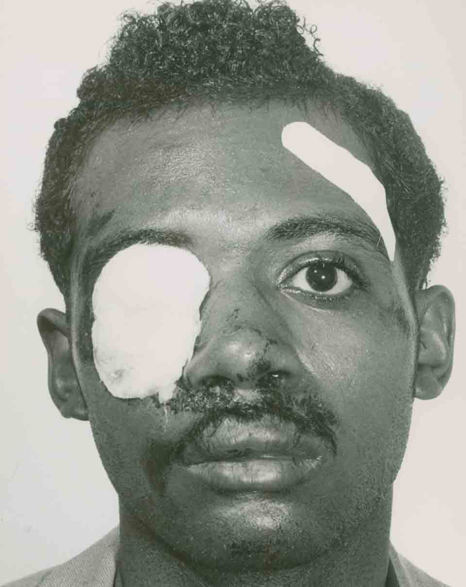 NAACP Police Brutality Victim